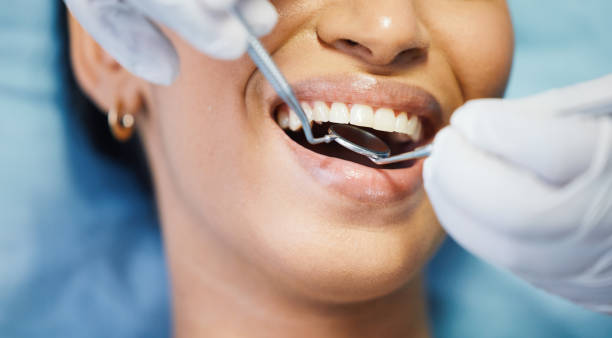 Best Emergency Treatment for Toothache in Independence, MO